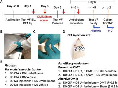 Potential mechanisms for osteopathic manipulative treatment to alleviate migraine-like pain in female rats